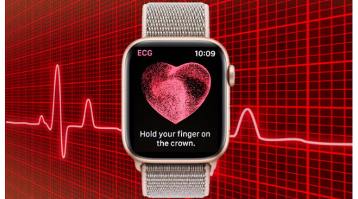 Apple Watch liệu có đáng tin cậy cho việc theo dõi chỉ số sức khỏe?