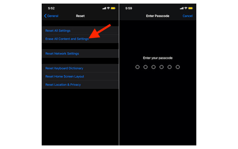 Chọn Erase All Content and Settings  Chọn Erase All Content and Settings