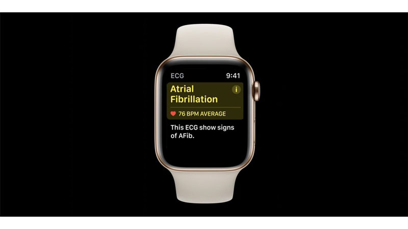 Tính năng HealthKit tiện dụng