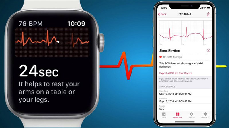 apple watch liệu có đáng tin hình 2 Apple Watch đưa ra những cảnh báo sức khỏe chưa chính xác