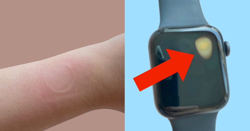 apple watch se gặp lỗi hình 2 apple watch se gặp lỗi