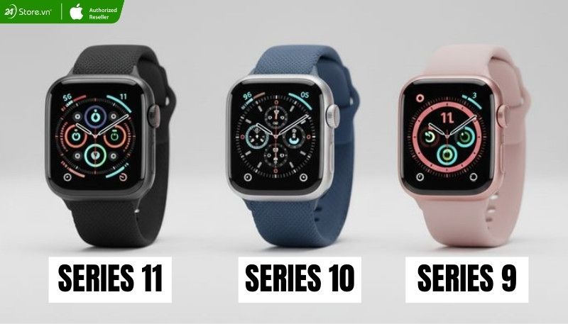 nên mua apple watch nào đẹp