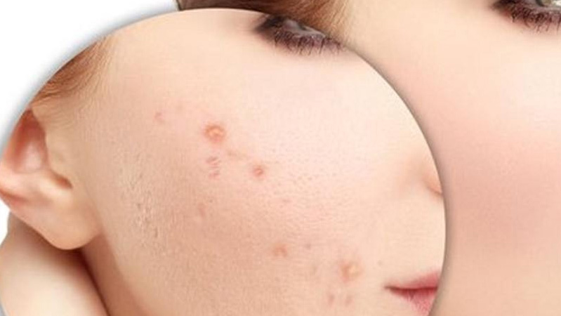 nuoc muoi vinh phuc 3 gia nuoc muoi sinh ly vinh phuc